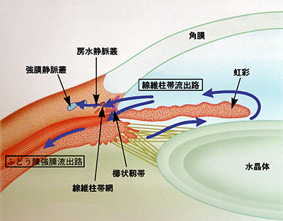 図1: 房水流出路障